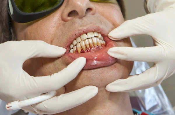 Visit to the dentist. Dentist at work in dental room