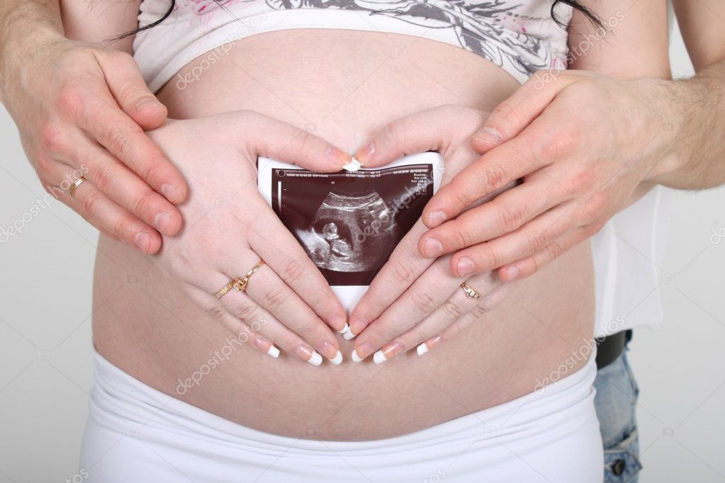 http://static9.depositphotos.com/1023771/1183/i/950/depositphotos_11839662-Pregnant-woman-holding-ultrasound-picture.jpg
