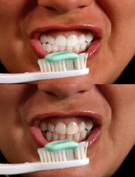 Clean White teeth
