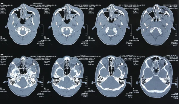 Magnetic resonance images