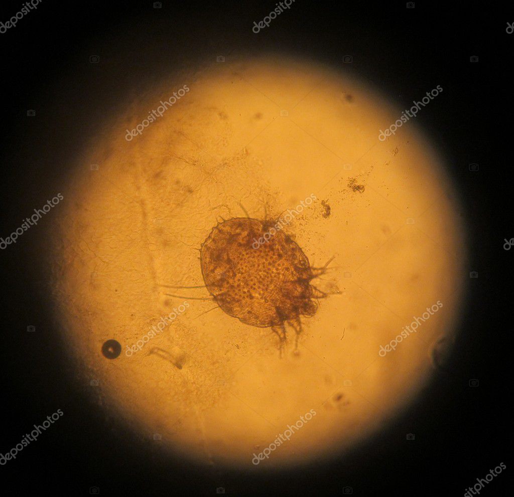scabies essay scabies essay