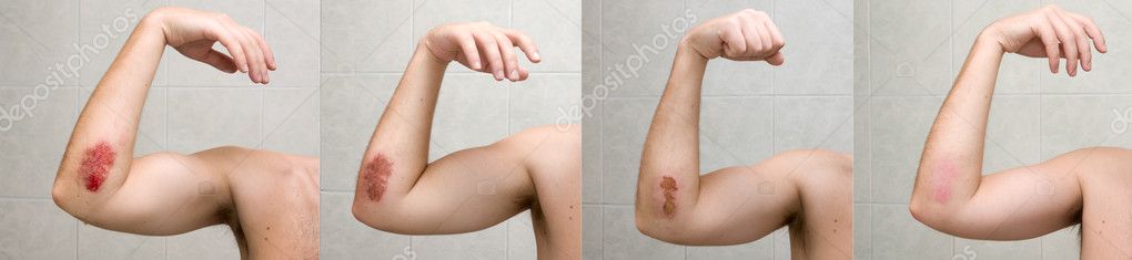 xxl sore xxl sore
