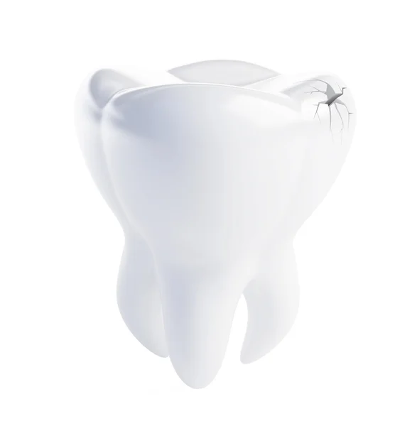 Grieta dental — Foto de Stock