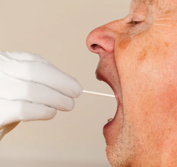 Un hisopo de ADN de saliva tomado de un hombre mayor — Foto de Stock