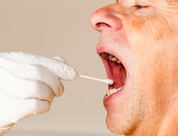 DNA swab of saliva taken from senior man — Stock Photo, Image