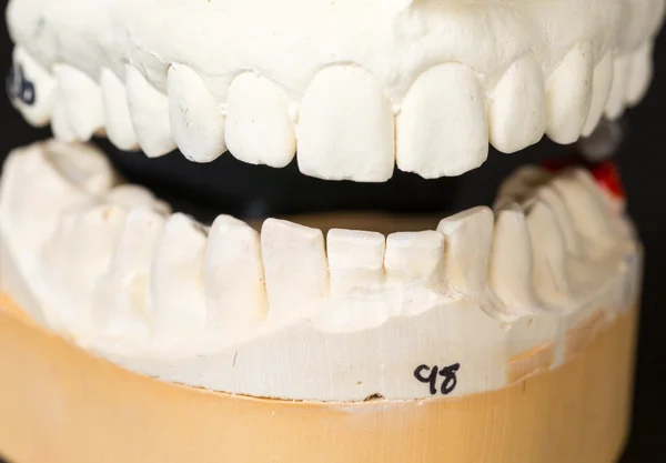 Mal van tanden genomen voor orthodontie — Stockfoto