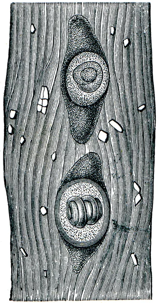 Trichina в капсулі м'язових волокон — стокове фото
