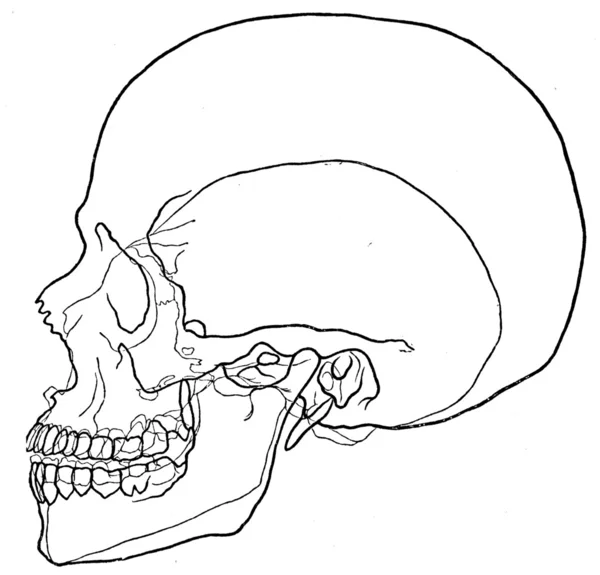 Microcephalic 해골, 정상적인 두개골에 그린 — 스톡 사진