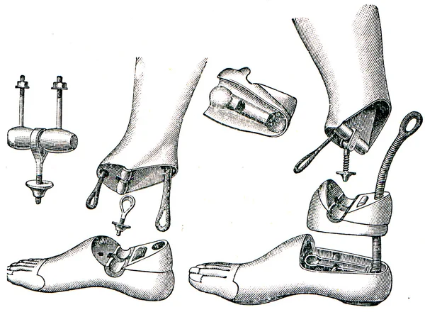 Προθέσεις - τεχνητά πόδια με απλή και διπλή αρθρώσεις — Φωτογραφία Αρχείου