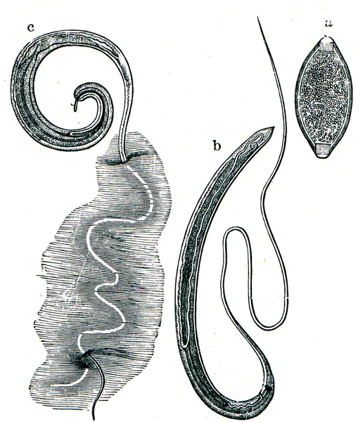 Whipworm (Trichocephalus dispar) — Stock Photo, Image