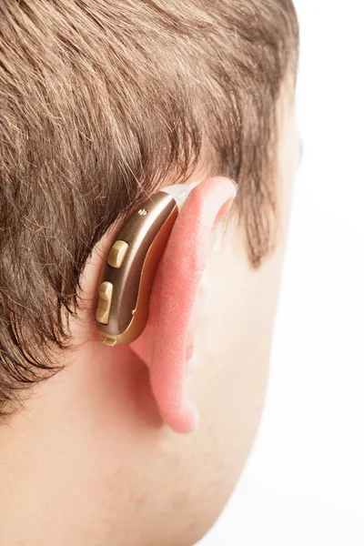 Aparat słuchowy — Zdjęcie stockowe