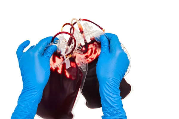 stock image Bag of blood in hand