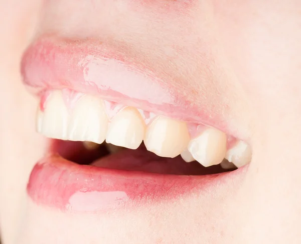 Sorridente bocca donna con grandi denti — Foto Stock