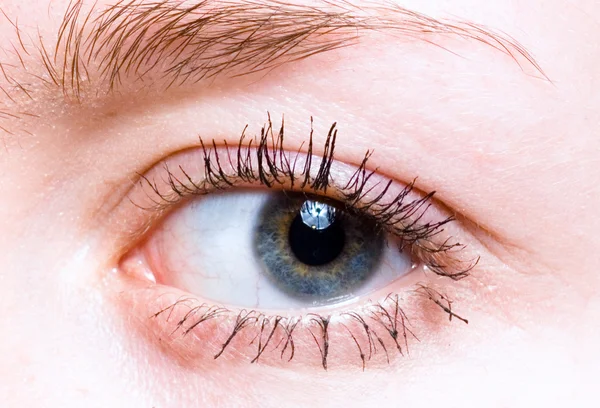 Primer plano de la inyección de ojo — Foto de Stock