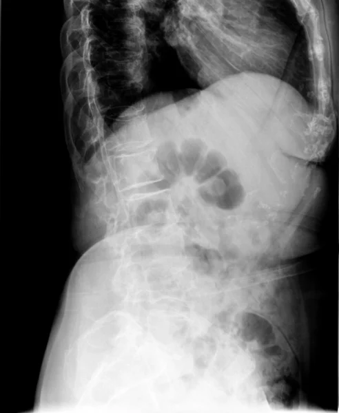 Radiografía de columna vertebral - Escaneo de columna vertebral corporal - vista lateral —  Fotos de Stock