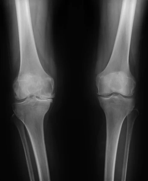 Orthostasis MRI: maintenance of an upright standing posture — Stock Photo, Image
