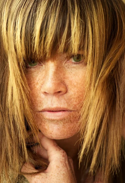 Attractive woman with freckles. — Stock Photo, Image
