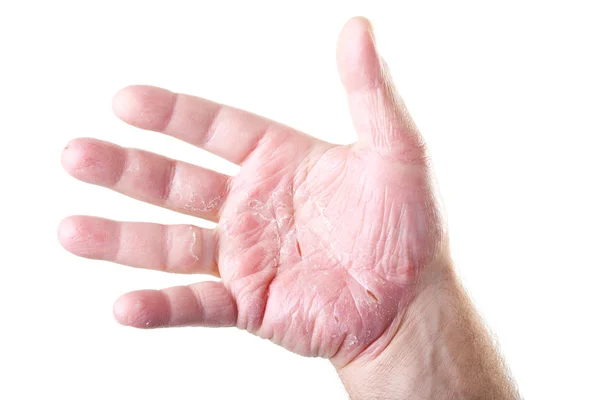 Mężczyzna dłoni z wypryskiem na białym tle — Zdjęcie stockowe