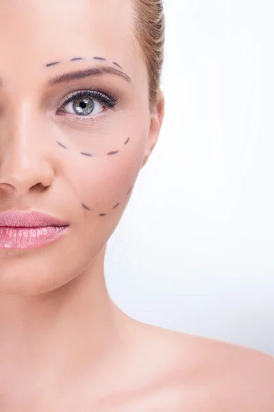 Marking for cosmetic plastic surgery — Stock Photo, Image