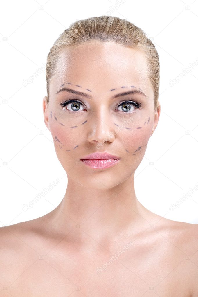 Woman whose face is marked with lines for facial cosmetic surger