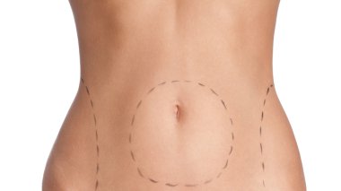 Belly plastic correction clipart