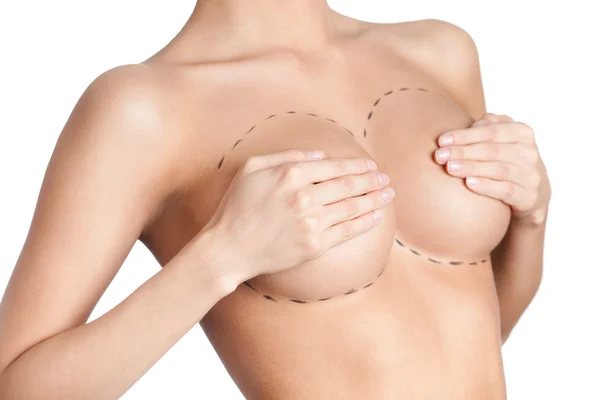 Correcção das glândulas mamárias — Fotografia de Stock