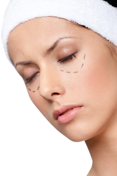 Facelift, plastic surgery