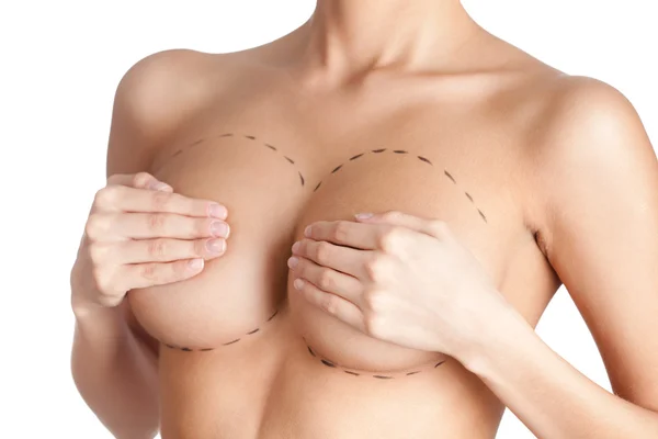 Tits correction. Plastic surgery — Stock Photo, Image