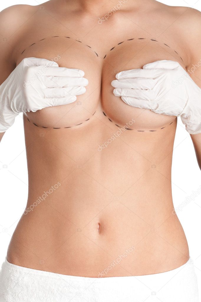 Breast plastic correction
