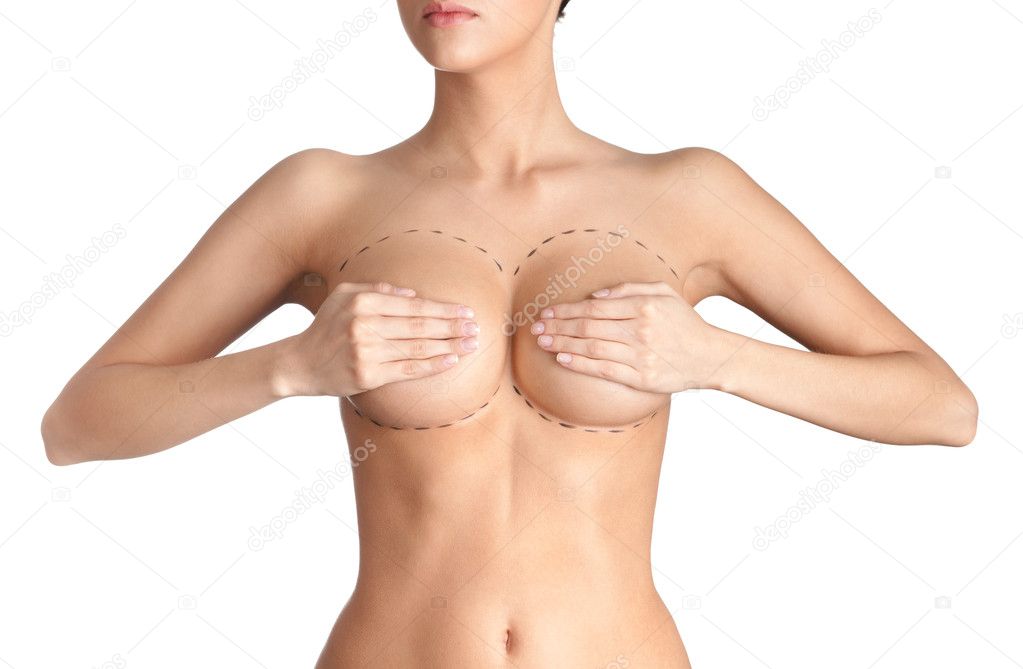 Outlined parts of breast plastic correction
