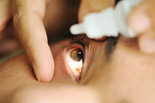 stock image Man sick with eye drops, hospital doctor examination