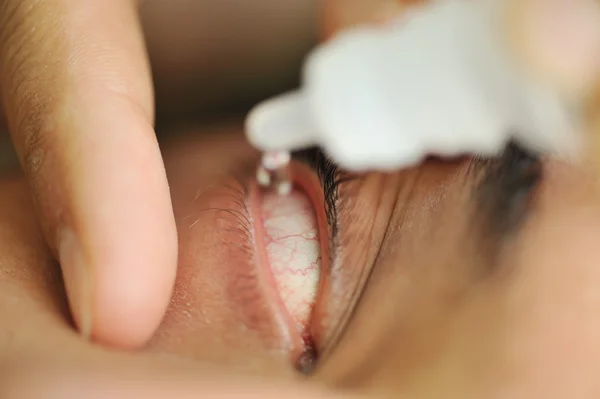 Hombre enfermo con gotas para los ojos, examen médico del hospital — Foto de Stock