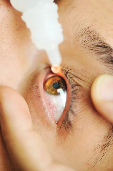 Человек болен глазными капельками, больничный врач осмотр — стоковое фото