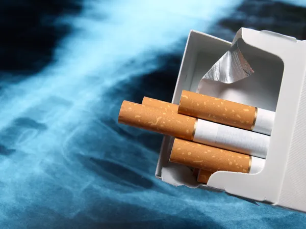 Lunge und Zigaretten — Stockfoto