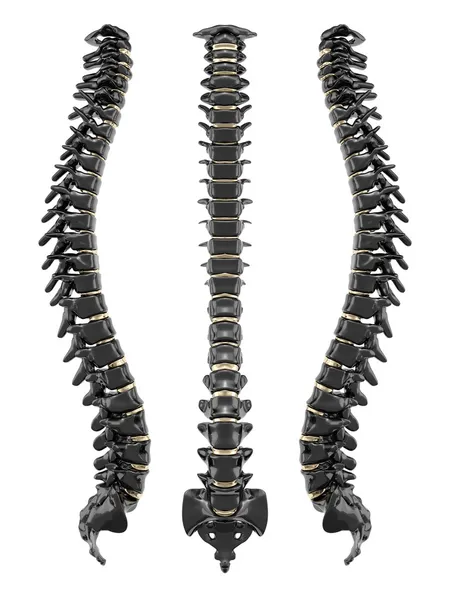 Spine black and golden — Stock Photo, Image