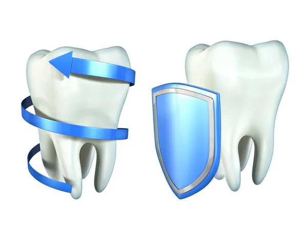 Teeth protection — Stock Photo, Image