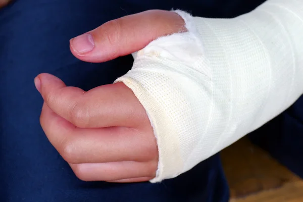 Сломанная рука с гипсовым броском вблизи — стоковое фото
