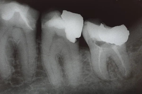 stock image View of teeth