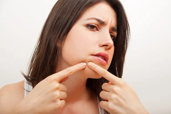 Jovem mulher examinando herpes em seu rosto — Fotografia de Stock