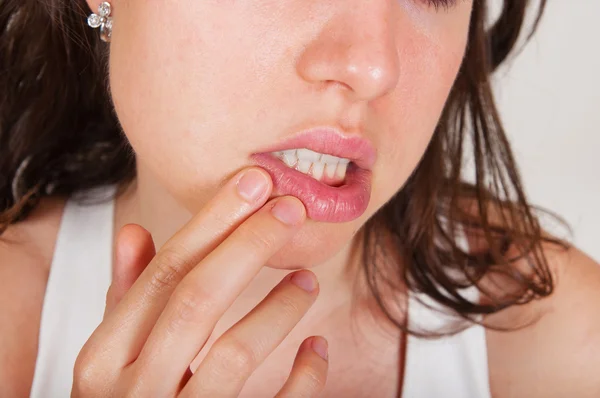 Jovem mulher examinando herpes em seu rosto — Fotografia de Stock