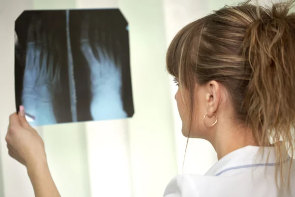 Sickness. Female doctor examining an x-ray — Stock Photo, Image