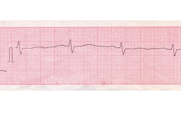 Schema di analisi cardiaca — Foto Stock