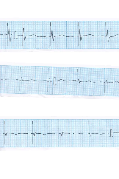 Corazón. cardiograma azul —  Fotos de Stock