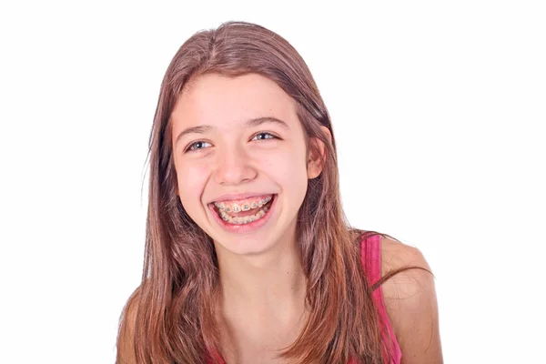 Beautiful young teen girl with brackets on teeth in white — Stock Photo, Image