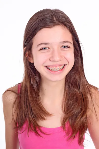 Krásná mladá dospívající dívka s závorkami na zubech v bílé — Stock fotografie