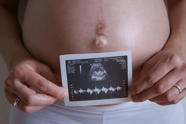 Pregnant — Stock Photo, Image