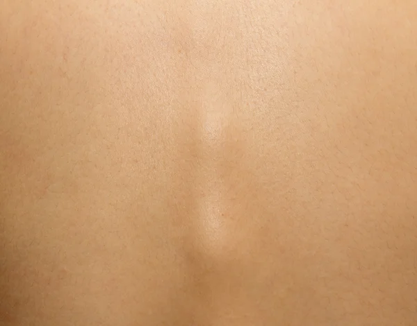 Huden på ryggen tätt med flickor som bakgrund — Stockfoto