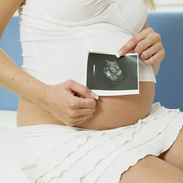 Pregnat woman with a sonogram of her baby — Stock Photo, Image