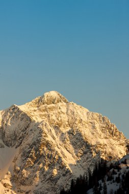 Vysoke Tatry (yüksek Tatras), Slovakya