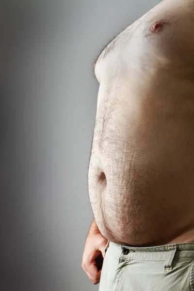Muž s velkým břichem vystavena — Stock fotografie